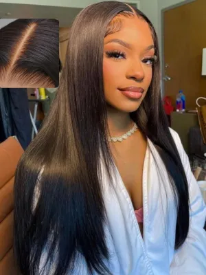 UNICE HD Real Scalp Wig 13x4 HD Lace Front Wigs Human Hair Black Layered Straight Glueless Frontal Wig Pre Plucked Pre Cut Bleached Knots Natural Hairline 180% Density 22 inch